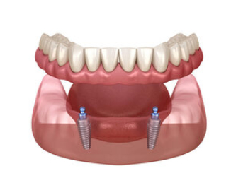 picture of human denture