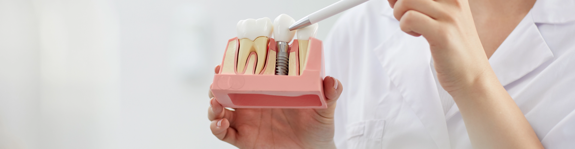 dentist point to teeth model showing teeth implant